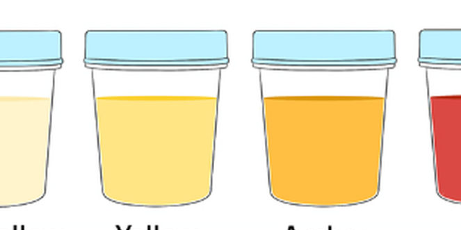 Temukan Daftar Lengkap, Penyakit yang Menyebabkan Darah dalam Urine, dan Kapan Harus Khawatir? Segera cek informasi ini.