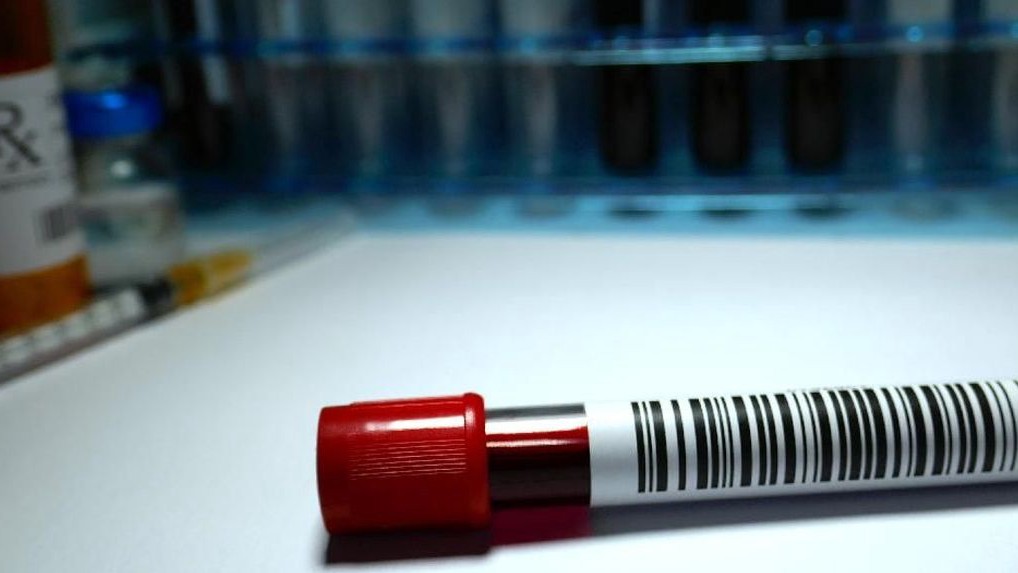 Temukan Kasus Kanker Darah Meningkat di Indonesia, Didominasi Leukemia, Waspada Sejak Dini mungkin