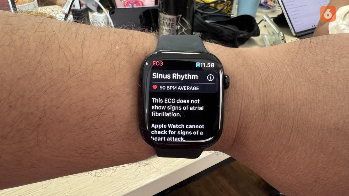 24 April Jadi Hari Spesial Pengguna Apple Watch, Ini Alasannya yang Mengejutkan!